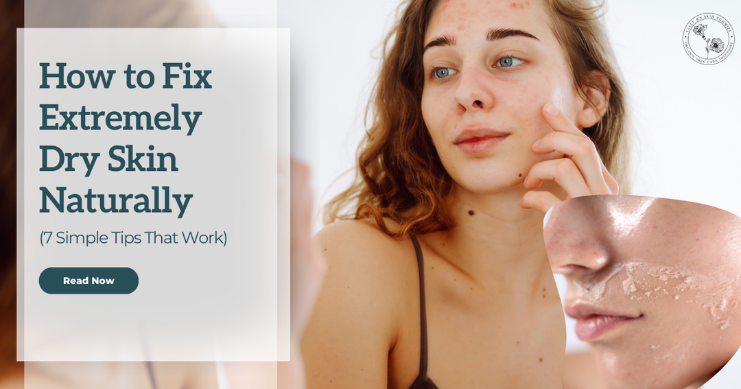 How to Fix Extremely Dry Skin Naturally (7 Simple steps that work)